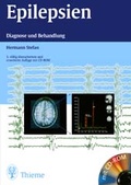 Cover: Epilepsien - Thieme