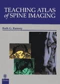 Cover: Teaching Atlas of Spine Imaging - Thieme Publishers