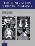 Cover: Teaching Atlas of Brain Imaging - Thieme