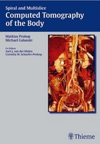 Abbildung von: Spiral and Multislice Computed Tomography of the Body - Thieme