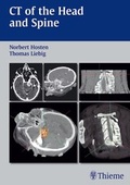 Cover: CT of the Head and Spine - Thieme