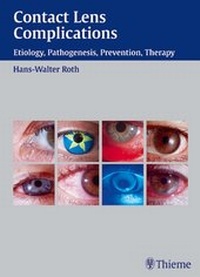 Abbildung von: Contact Lens Complications - Thieme