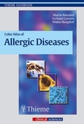 Cover: Color Atlas of Allergic Diseases - Thieme