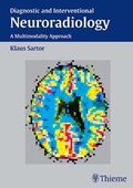 Cover: Diagnostic and Interventional Neuroradiology - Thieme