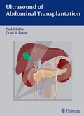 Cover: Ultrasound of Abdominal Transplantation - Thieme