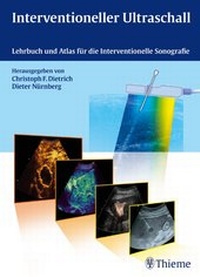 Abbildung von: Interventioneller Ultraschall - Thieme