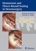 Cover: Hemostasis and Fleece-Bound Sealing in Neurosurgery - Thieme