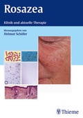 Cover: Rosazea - Thieme