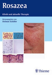 Enlarge image Cover: Rosazea - Thieme