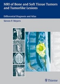 Abbildung von: MRI of Bone and Soft Tissue Tumors and Tumorlike Lesions - Thieme
