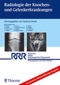 Cover: Radiologie der Knochen- und Gelenkerkrankungen - Thieme