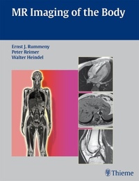 Abbildung von: MR Imaging of the Body - Thieme