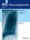 Cover: Thoraxdiagnostik - Thieme