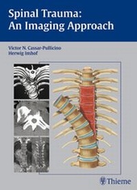 Enlarge image Cover: Spinal Trauma - An Imaging Approach - Thieme
