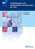 Cover: Fehlbildungen und fr&uuml;hkindliche Sch&auml;digungen des ZNS - Thieme