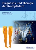 Cover: Diagnostik und Therapie der Krampfadern - Thieme