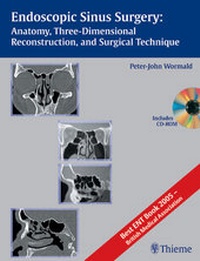 Abbildung von: Endoscopic Sinus Surgery (incl. CD-ROM) - Thieme