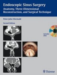 Abbildung von: Endoscopic Sinus Surgery - Thieme
