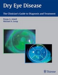 Abbildung von: Dry Eye Disease - Thieme