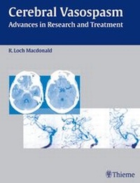 Enlarge image Cover: Cerebral Vasospasm - Thieme