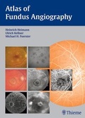 Cover: Atlas of Fundus Angiography - Thieme