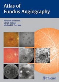 Enlarge image Cover: Atlas of Fundus Angiography - Thieme