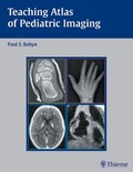Cover: Teaching Atlas of Pediatric Imaging - Thieme