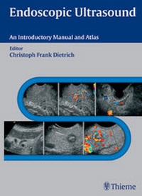 Abbildung von: Endoscopic Ultrasound - Thieme