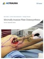 Cover: Minimally Invasive Plate Osteosynthesis - Thieme