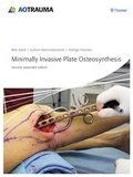 Cover: Minimally Invasive Plate Osteosynthesis - Thieme
