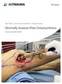 Enlarge image Cover: Minimally Invasive Plate Osteosynthesis - Thieme