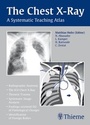Cover: The Chest X-Ray - Thieme