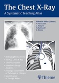 Cover: The Chest X-Ray - Thieme
