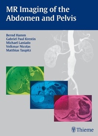 Abbildung von: MR Imaging of the Abdomen and Pelvis - Thieme