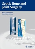 Cover: Septic Bone and Joint Surgery - Thieme