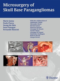 Bild: Microsurgery of Skull Base Paragangliomas - Thieme