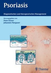 Enlarge image Cover: Psoriasis - Thieme