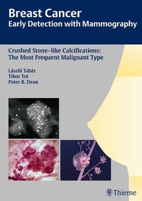 Abbildung von: Breast Cancer: Early Detection with Mammography - Thieme
