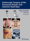 Cover: Endoscopic Surgery of the Paranasal Sinuses and Anterior Skull Base - Thieme