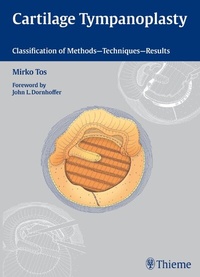 Abbildung von: Cartilage Tympanoplasty - Thieme