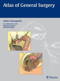 Abbildung von: Atlas of General Surgery - Thieme