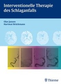 Cover: Interventionelle Therapie des Schlaganfalls - Thieme