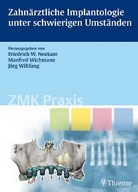 Abbildung von: Zahnärztliche Implantologie unter schwierigen Umständen - Thieme