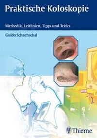 Abbildung von: Praktische Koloskopie - Thieme