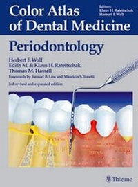 Abbildung von: Color Atlas of Dental Medicine: Periodontology - Thieme