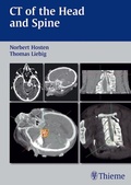 Cover: CT of the Head and Spine - Thieme