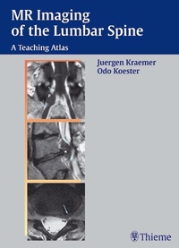 Abbildung von: MR Imaging of the Lumbar Spine - Thieme