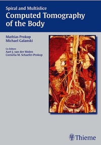 Abbildung von: Spiral and Multislice Computed Tomography of the Body - Thieme