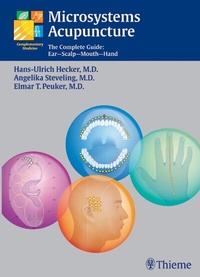 Abbildung von: Microsystems Acupuncture - Thieme
