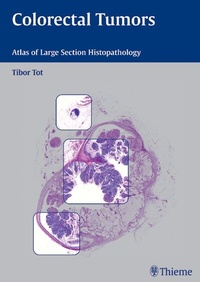 Abbildung von: Colorectal Tumors - Thieme